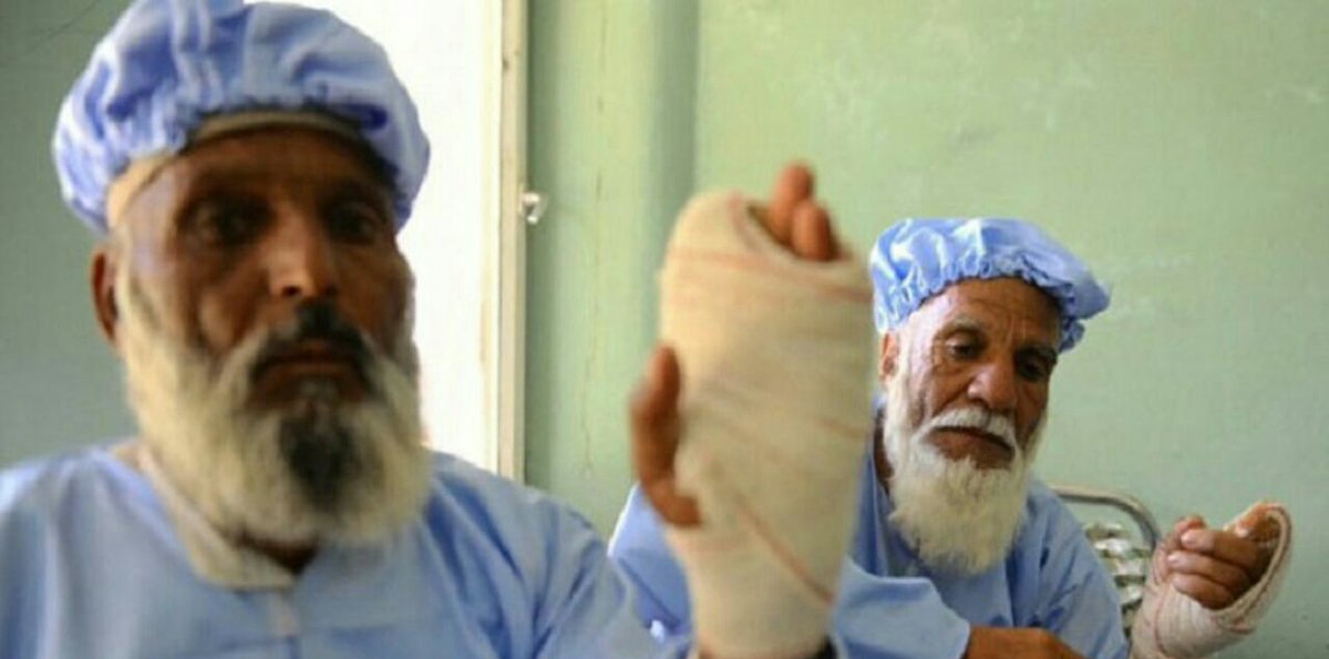  قطع انگشت رای دهندگان در افغانستان +عکس 