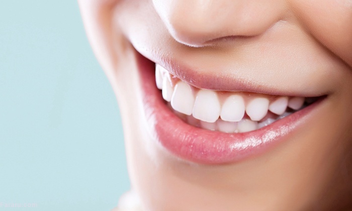 برای سفید کردن دندان‌ها چه کنیم؟