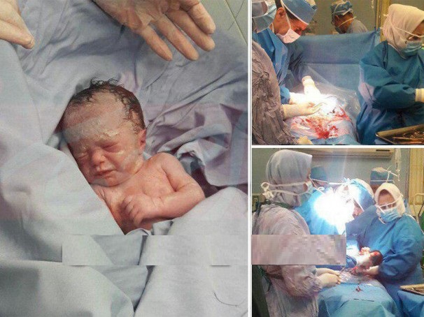 تولد جنین فریز شده پس از ۱۴ سال در اصفهان +عکس