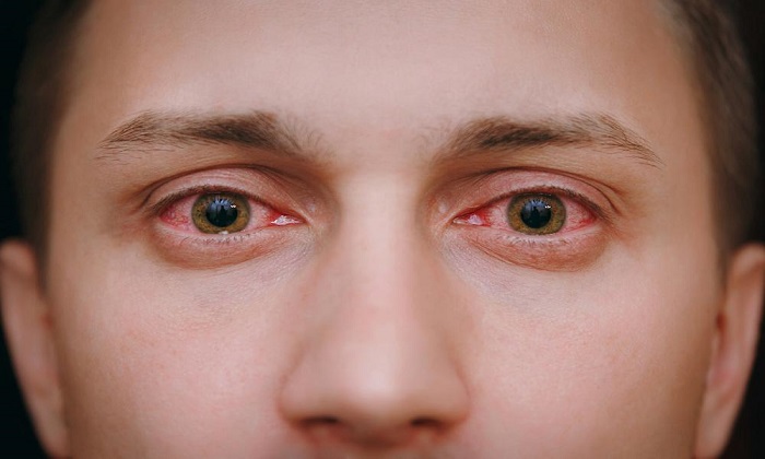 9نشانه یک عفونت چشمی خطرناک