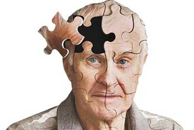 بیماری صرع باعث تسریع در روند پیری مغز می شود؟
