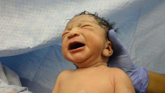 پرستار عامل قطع انگشت نوزاد تحت تعقیب قرار گرفت