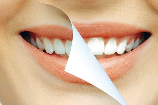 چند عادت غلط که دندان‌های شما را زرد می‌کند