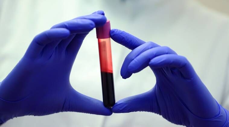  نگران انتقال ویروس کرونا در مراکز اهدای خون نباشید