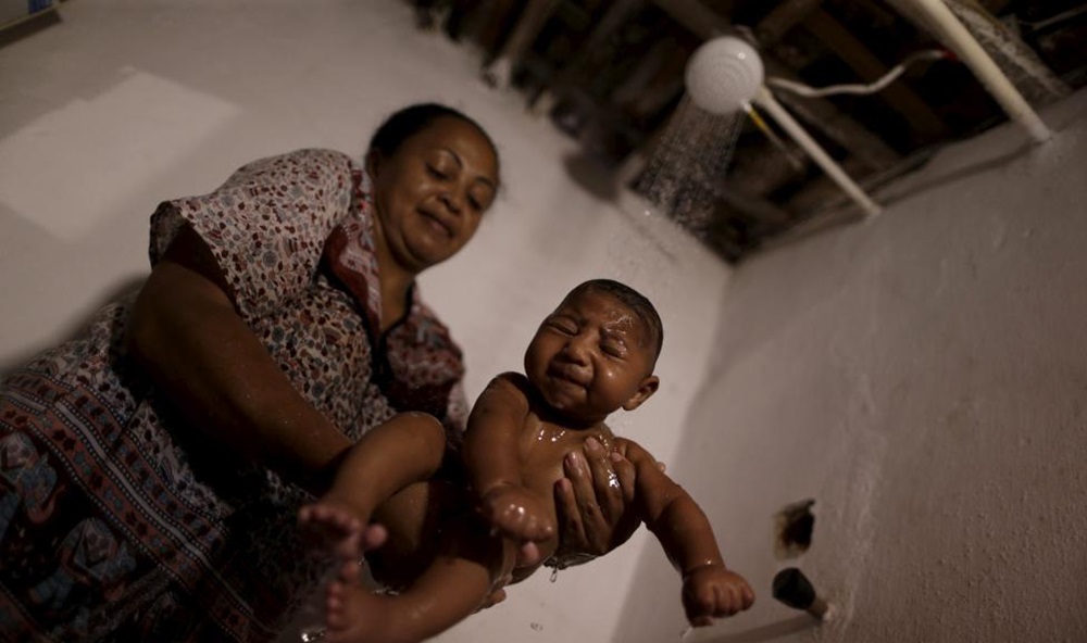 نوزادان مبتلا به ویروس زیکا +تصاویر