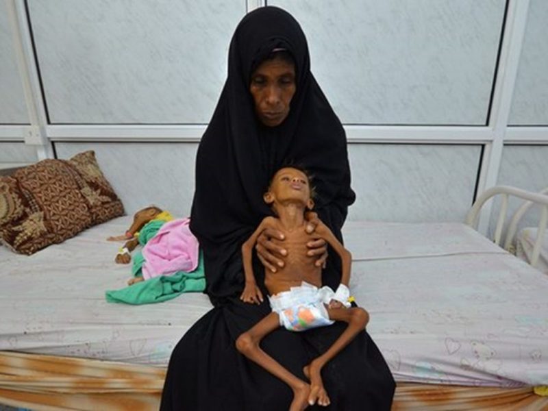 سازمان ملل نسبت به خطر گرسنگی 10میلیون یمنی هشدار داد