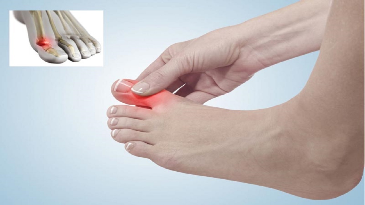 این ۴ بیماری با درد انگشت شصت پا خود را نشان می دهند