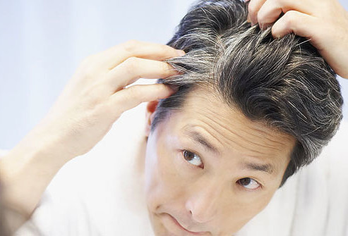 پنج عامل که در خاکستری شدن زودهنگام موها تاثیر دارد