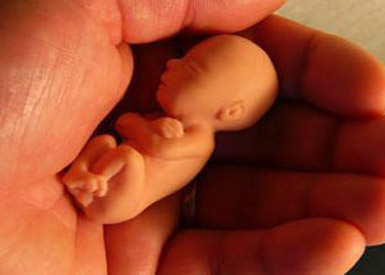 آمار تکاندهنده سقط جنین پنهانی