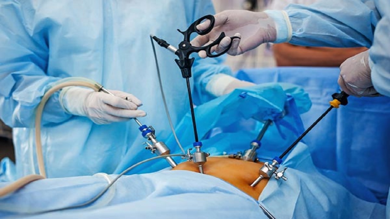 عوارض مرگ آفرین جراحی های لاغری