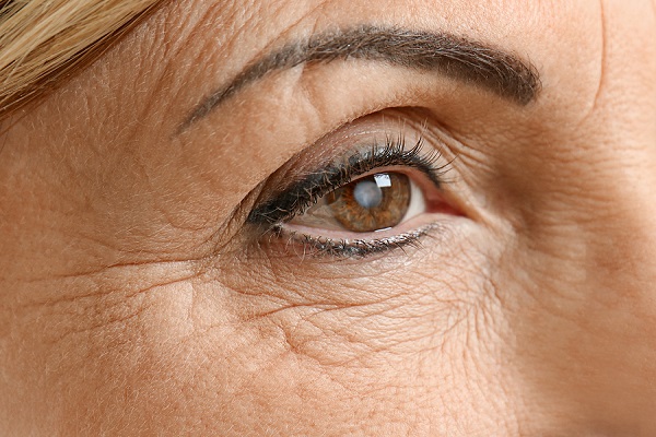 راه‌های درمان سندرم خشکی چشم