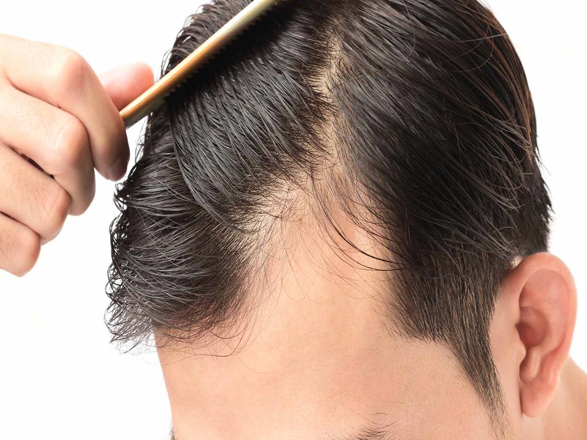 راه حل هایی برای از بین بردن خشکی مو

