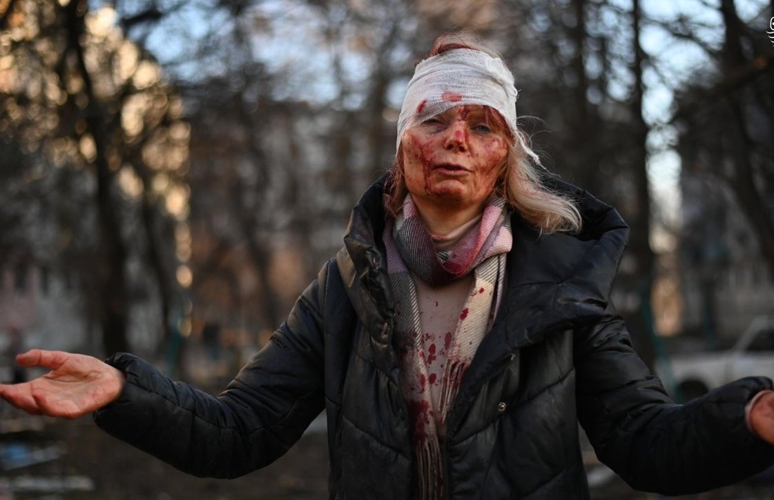 داستان عکس تکان دهنده از زن اوکراینی