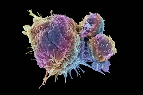 یک ارتباط مرموز در بدن: سطح اکسیژن و سلول سرطانی!