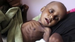 یمنی‌ها دیگر غذایی برای خوردن ندارند