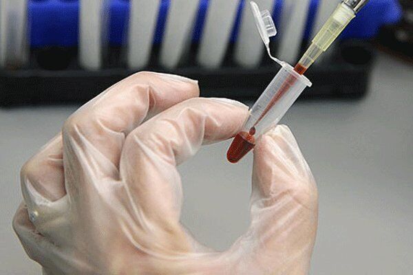 ذخیره سازی ۸۰۰ نمونه خون بند ناف در خراسان جنوبی
