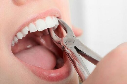 ۶ دلیل برای دندان درد شما