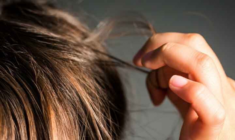 اختلال وسواس مو کندن در نوجوانان را جدی بگیرید + درمان