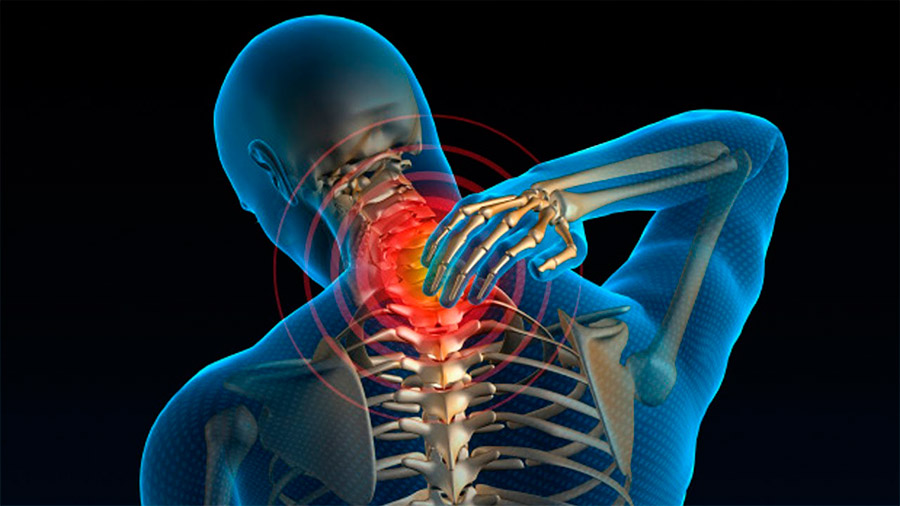شایع ترین عوامل بروز دیسک گردن و درمان آن