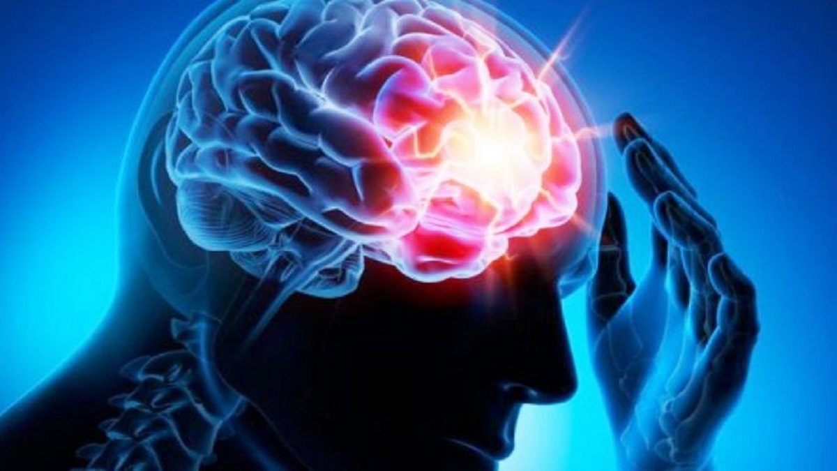 عامل اصلی تشنج‌ های صرعی در مغز چیست؟