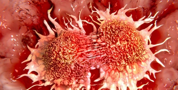 هزاران زن در معرض سرطان تخمدان