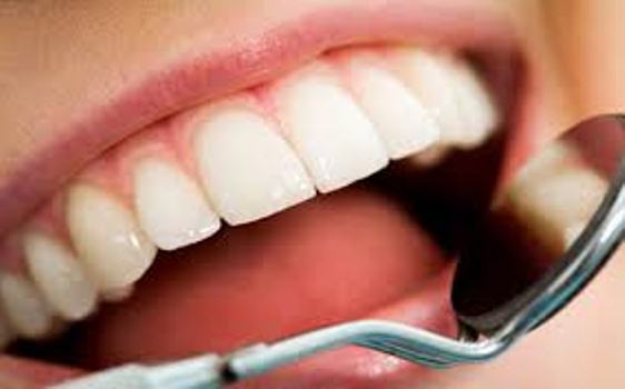  شاخص پوسیدگی دندان در کشور افزایش یافته است