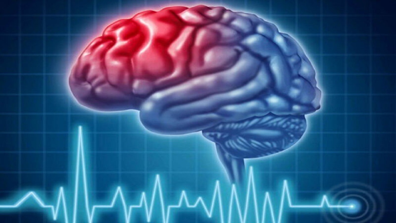 مراجعه  ۴۰ هزار بیمار سکته مغزی از ابتدای امسال به مراکز درمانی