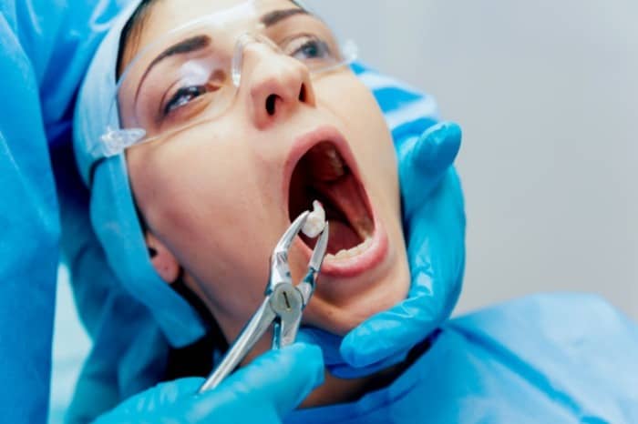 دلیل رشد با تاخیر دندان عقل چیست؟