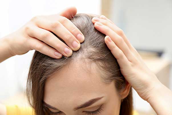 ریزش مو نشانه چه بیماری هایی است؟