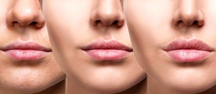 ۱۴ راه برای داشتن لب‌ هایی سالم