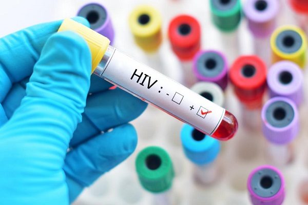 ایدز و رفتار های پرخطر
