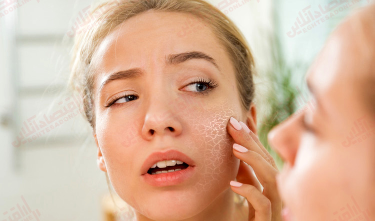 درمان سریع خشکی پوست با روش طبیعی
