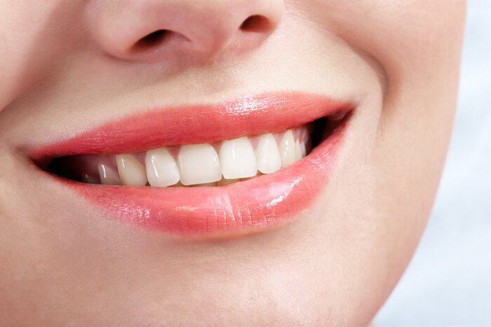 چگونه از پوسیدگی دندان‌های خود پیشگیری کنیم؟