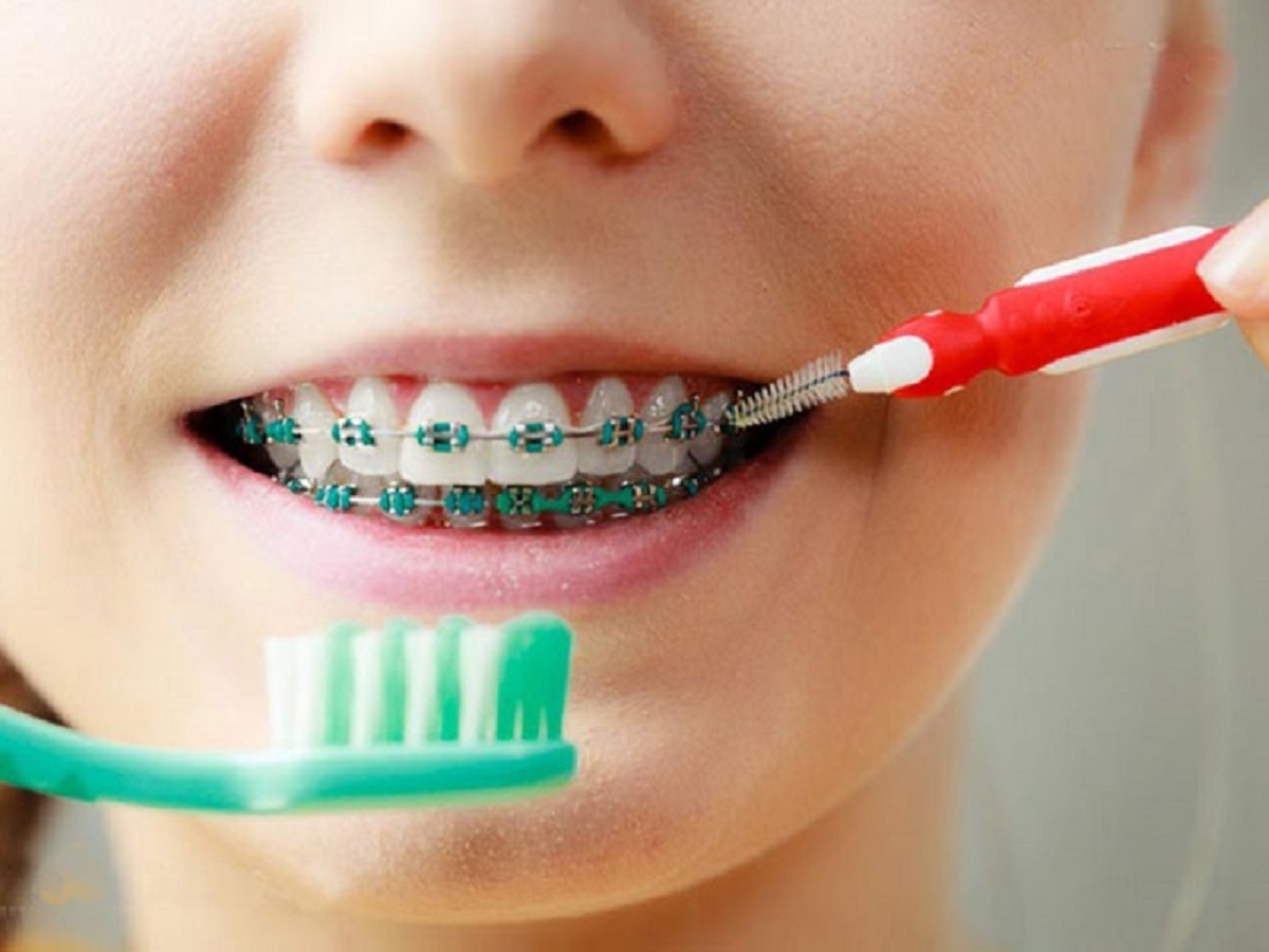 معیارهای انتخاب خمیر دندان مناسب