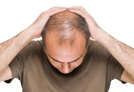 4 روش برای جلوگیری از ریزش مو