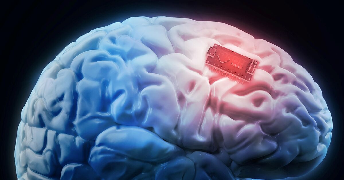 ایمپلنت تراشه‌ های الکترونیکی در مغز انسان در راه تحقق