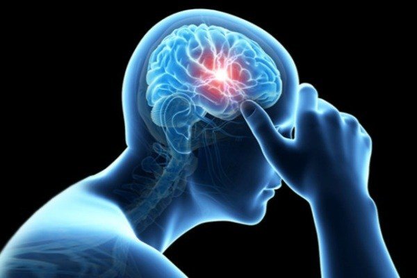یکی از عوامل اصلی سکته مغزی چیست؟