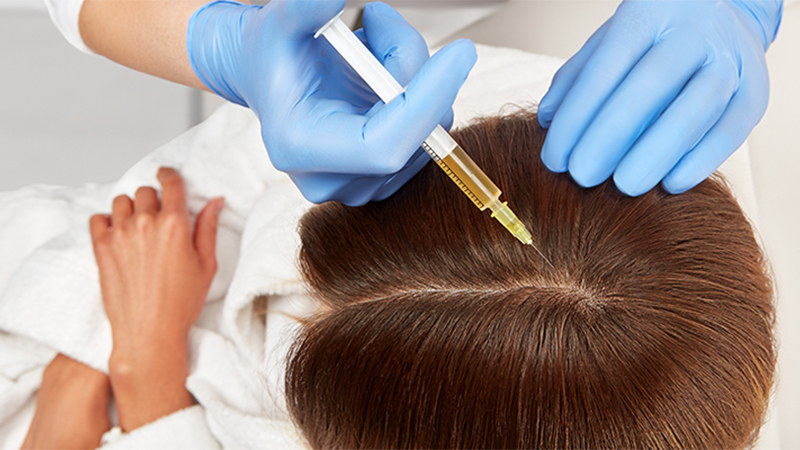 مزوتراپی و پی آر پی از بهترین روش‌ها برای درمان ریزش مو