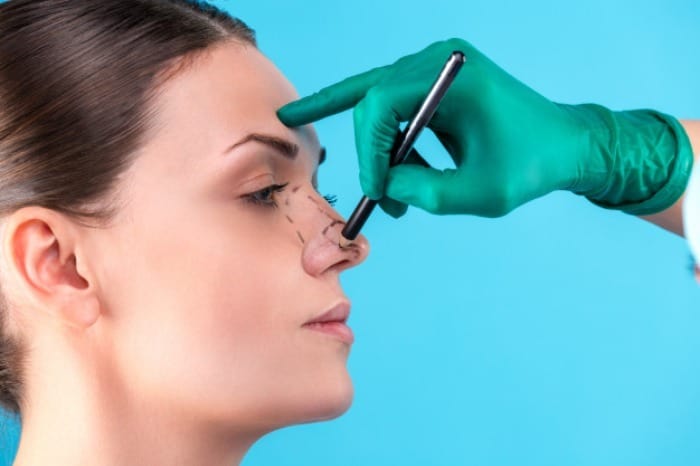  چرا نباید تا قبل از ١٧ سالگی بینی تان را جراحی کنید؟