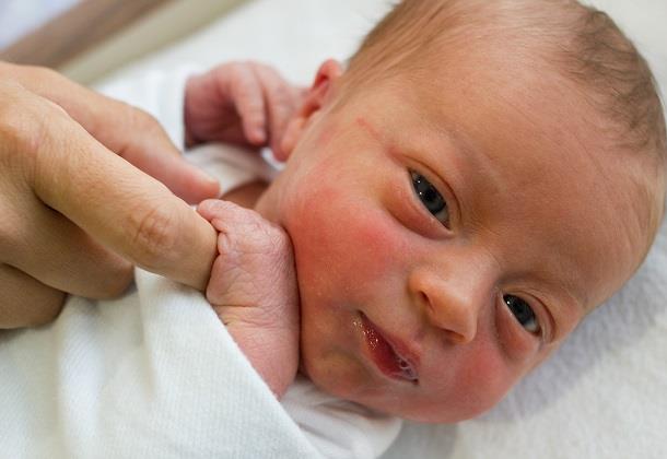 چگونه متوجه زردی نوزاد شده و در خانه درمان کنیم؟ +علائم