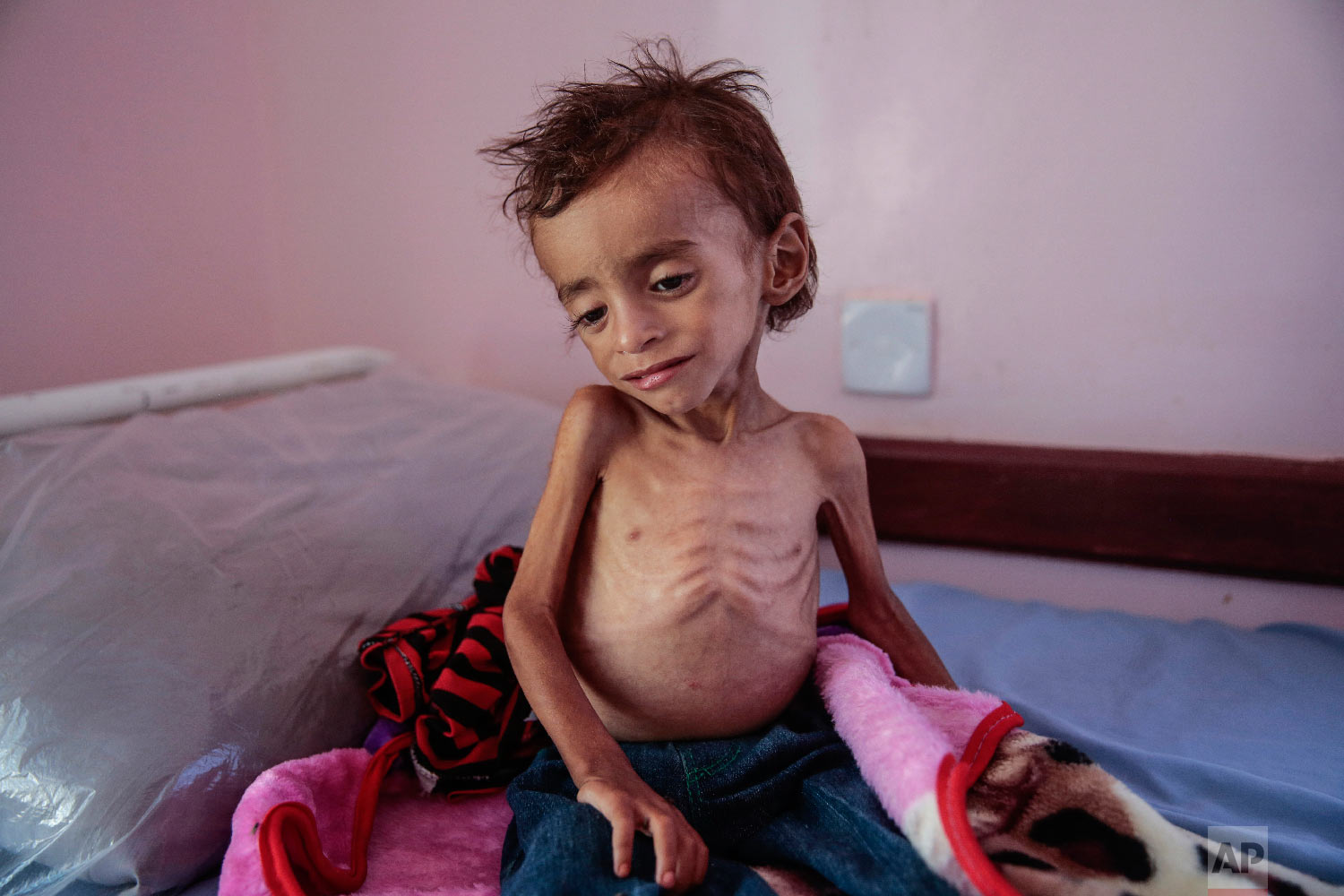 تصاویر وحشتناک از کودکان یمنی +فیلم
