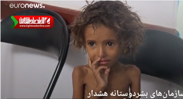 تصاویری از قحطی و گرسنگی شدید در یمن +فیلم