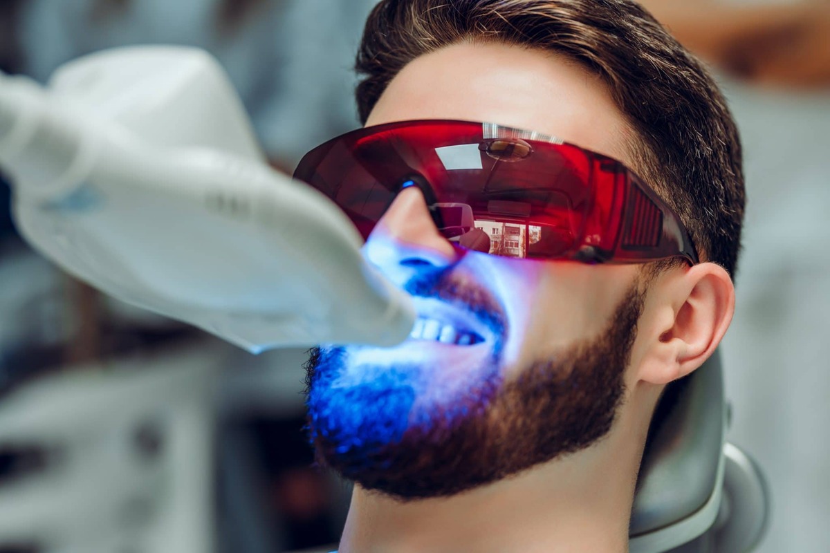 روش سفید کردن دندان با LED چیست؟