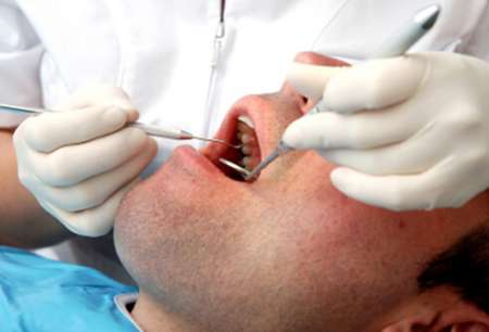 علایم سرطان دهان را بشناسید