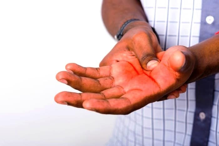 دلیل و علت غیر قلبی سنگینی دست چپ چیست؟