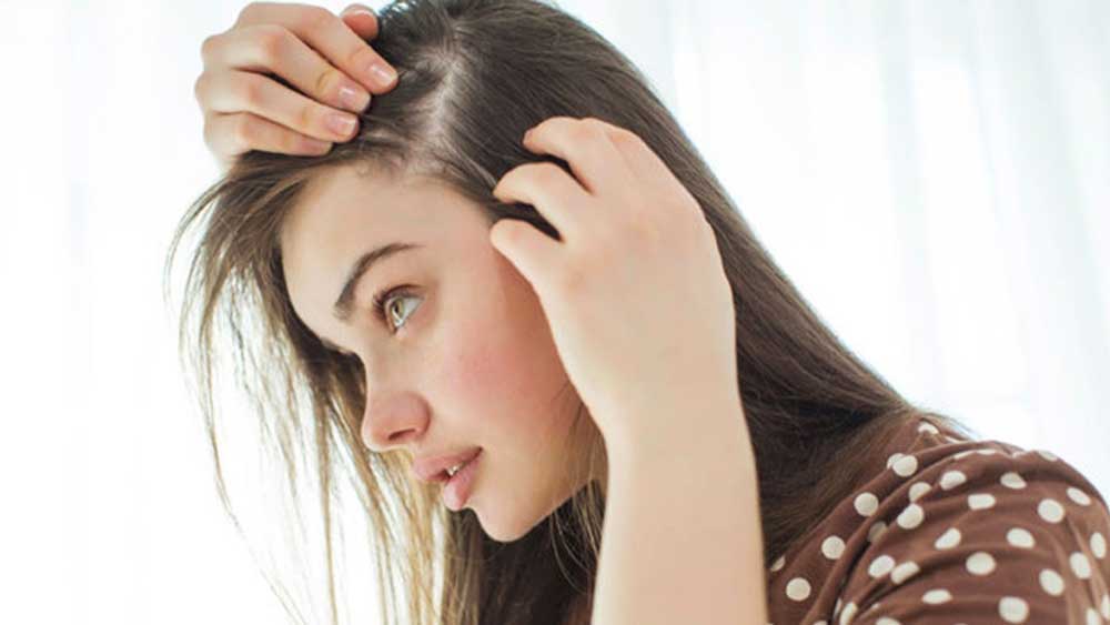 مهمترین دلایل ریزش مو در خانم ها چیست؟