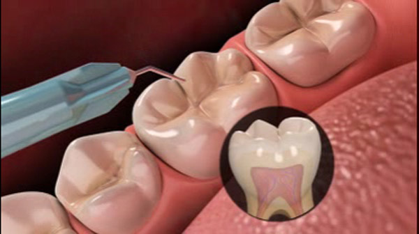 
کشف روش تولید مینای دندان! +عکس