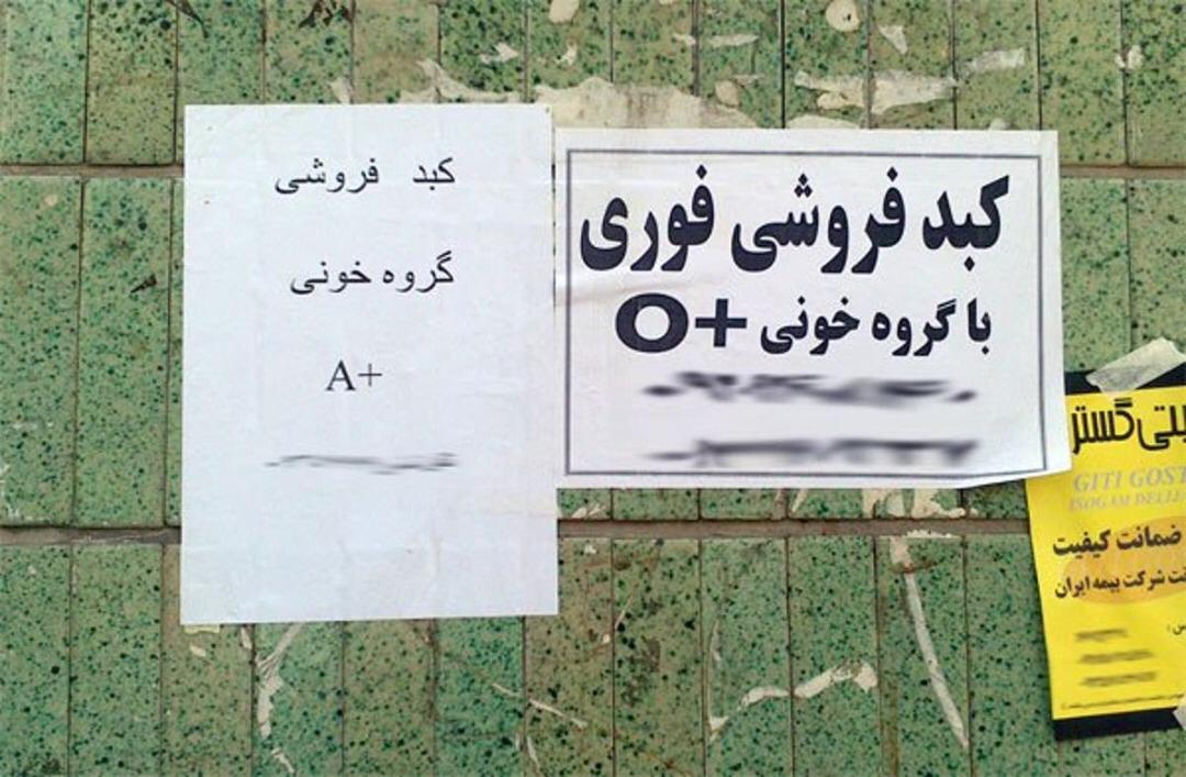مزایده جان برای نان/ بازار پررونق خرید و فروش کبد در ایران