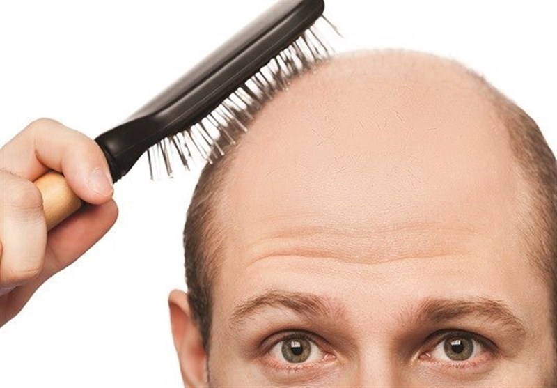 راهکار ساده طب سنتی برای کاهش ریزش مو 