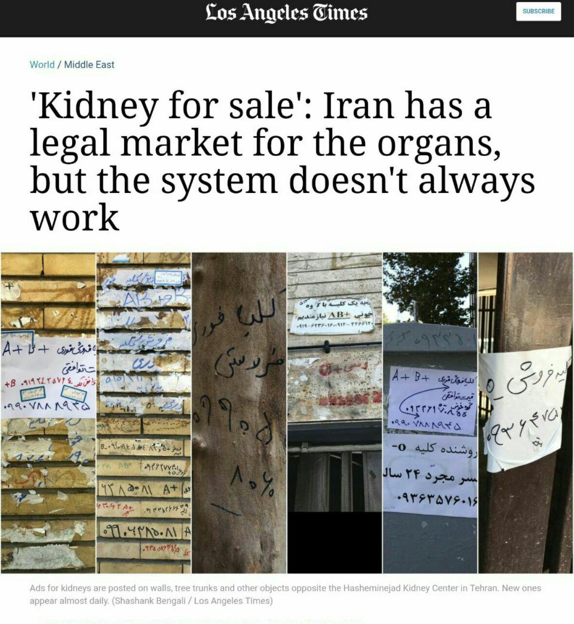 ایران تنها بازار فروش قانونی کلیه